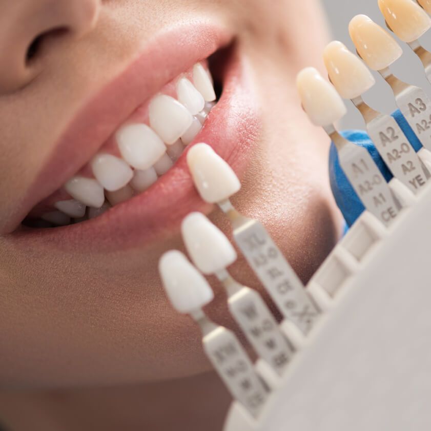 Dentist explaining to women about Dental Crowns | Kokua Smile