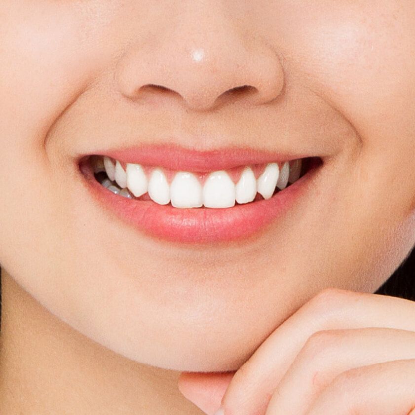 https://kokuasmiles.tradebuilderinc.comA woman showcasing her teeth whitening results | Kokua Smile