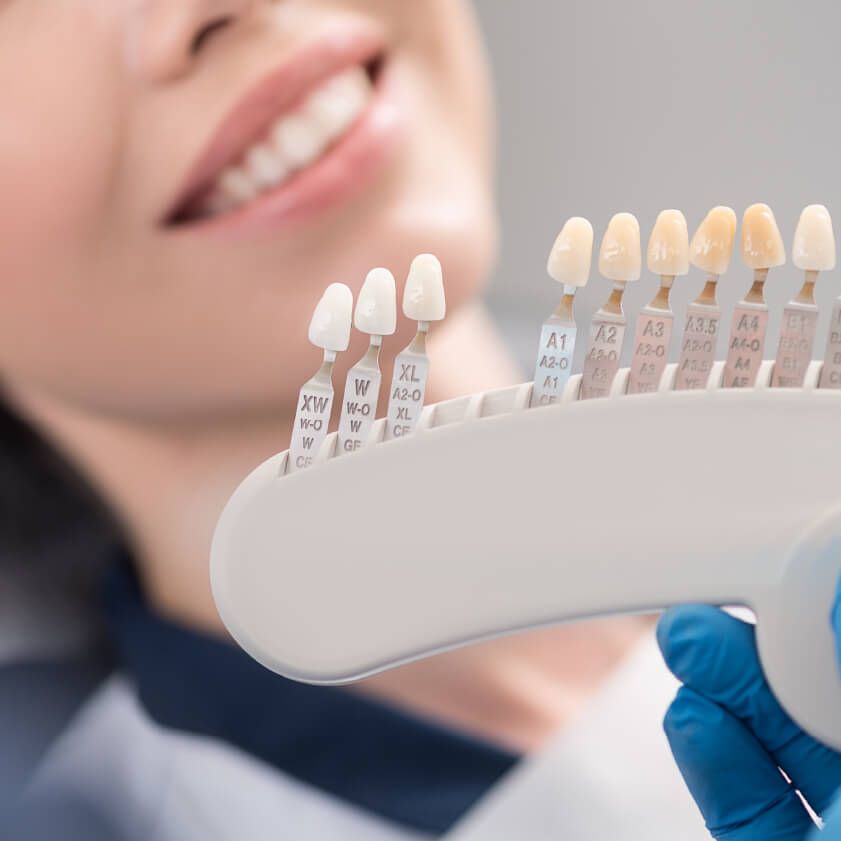Image of a dentist suggesting veneers as a dental treatment option | Kokua Smile 